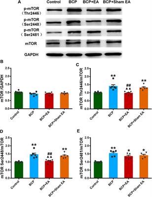 Phosphoproteomic Profiling of Rat’s Dorsal Root Ganglia Reveals mTOR as a Potential Target in Bone Cancer Pain and Electro-Acupuncture’s Analgesia